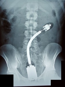 Xtreme X-rays - Dildo