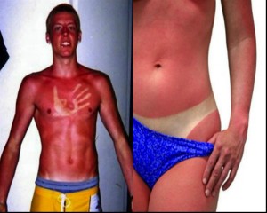 Horrific Side of a Summer Tan - Out of Touch